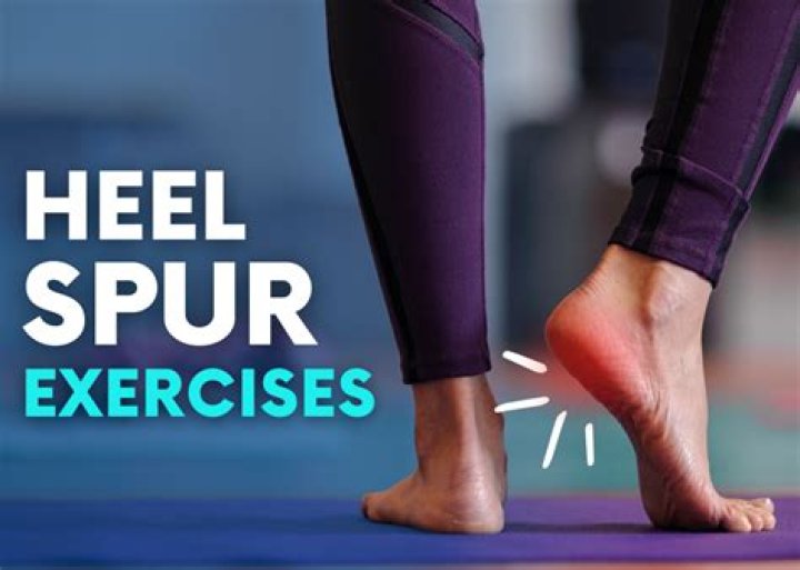 Can you workout with a heel spur?