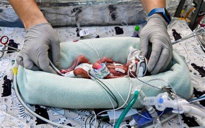 Do 38 week babies go to NICU?