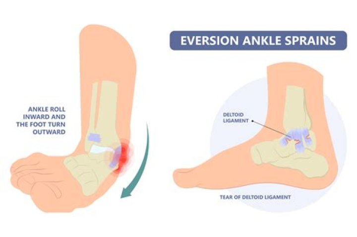 Do ankle injuries ever heal?