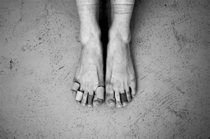 Do ballerinas cut their feet?