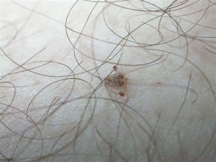 Do body lice burrow into skin?
