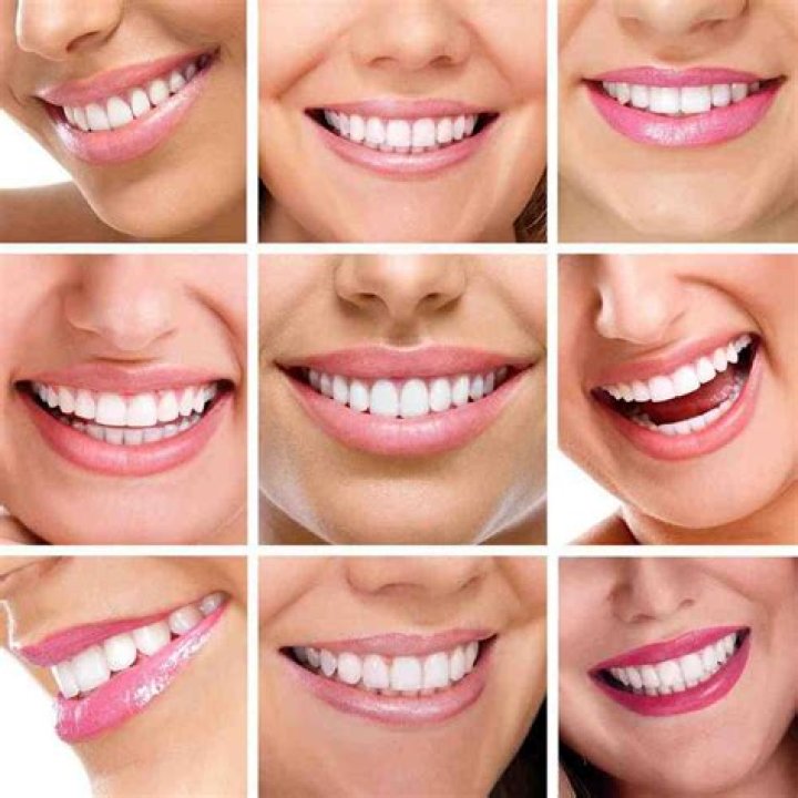 Do crowns on front teeth look natural?