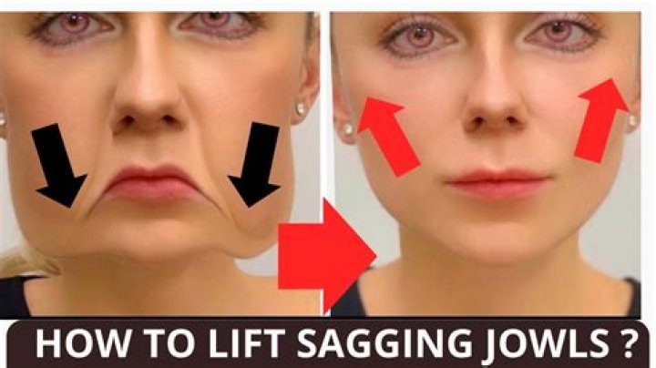 Do facial exercises work for sagging jowls?
