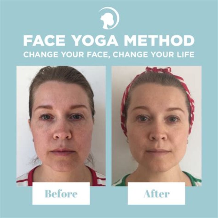 Do facial exercises work?
