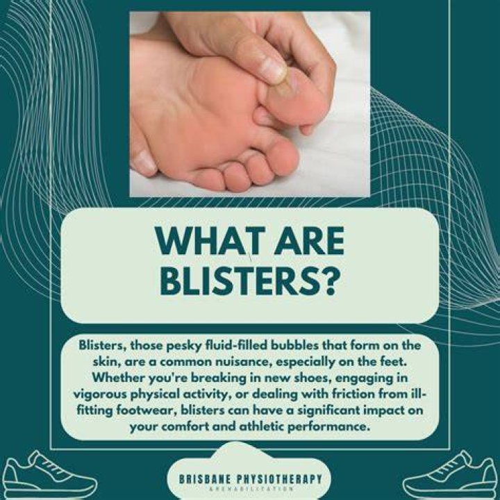 Do golf gloves stop blisters?