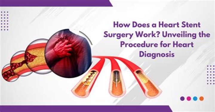 Do heart stents hurt?