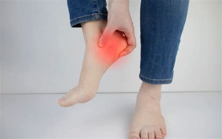 Do heel cups help plantar fasciitis?