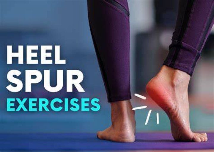Do night splints help heel spurs?
