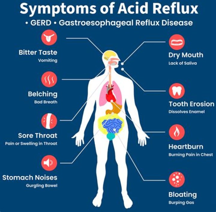 Do peppers cause acid reflux?