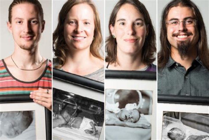 Do premature babies look different as adults?