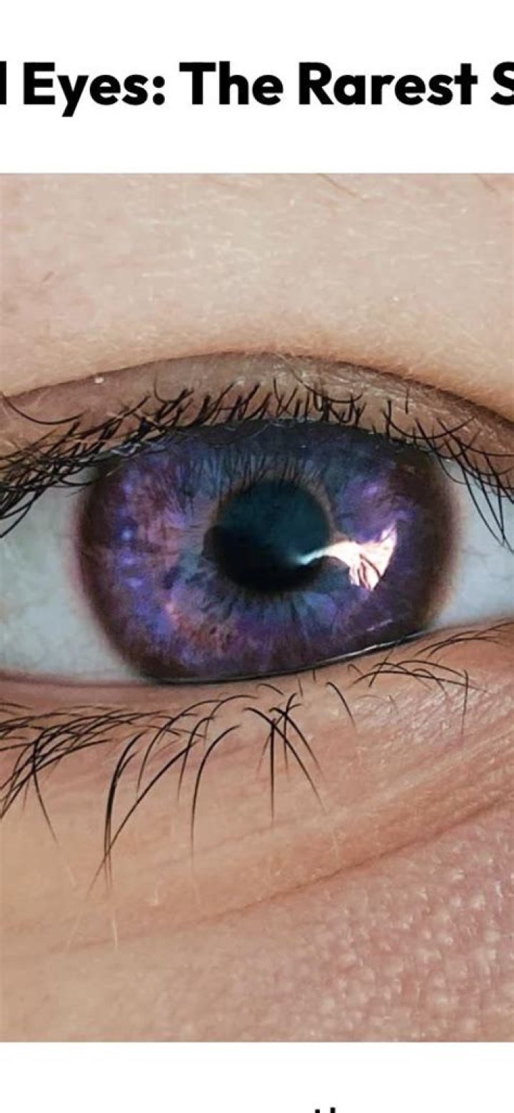 Do robotic eyes exist?