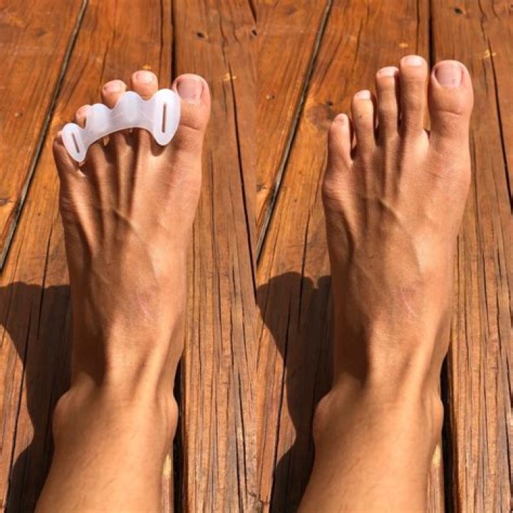 Do toe separators work?