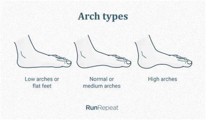 Do you need arch support if you have high arches?