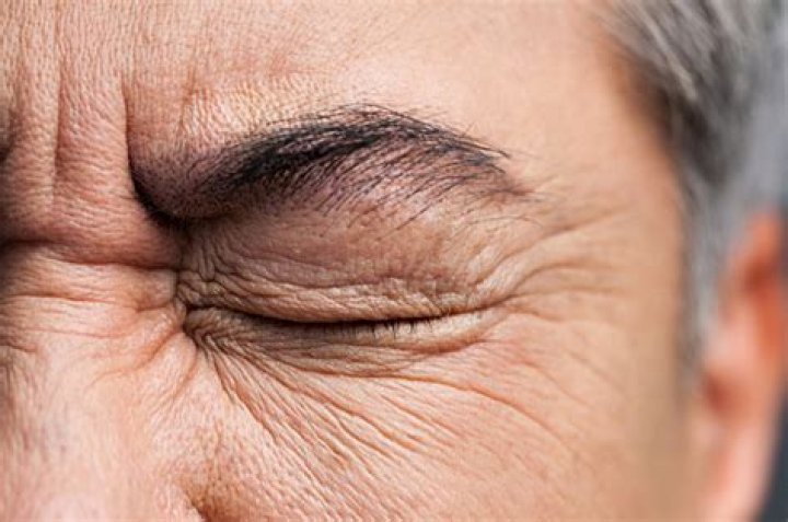 Do your eyes turn GREY when you become blind?