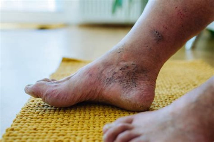 Does a pitcher's foot have to be on the rubber?