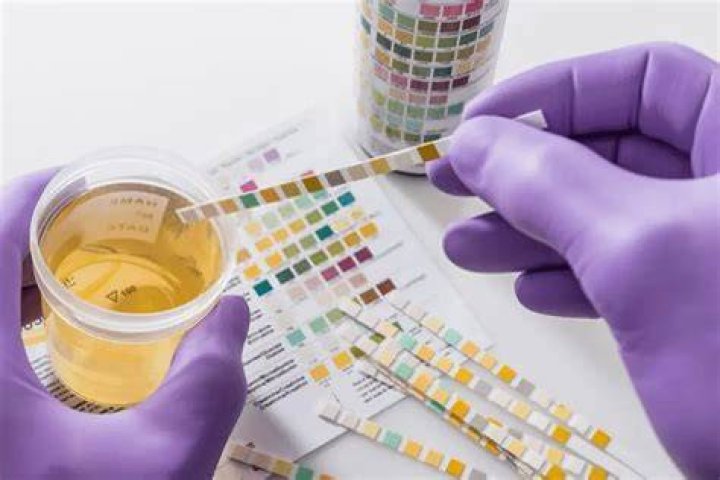 Does a UTI smell?