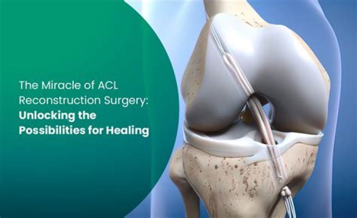 Does ACL need surgery?