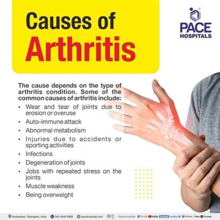 Does arthritis hurt all the time?