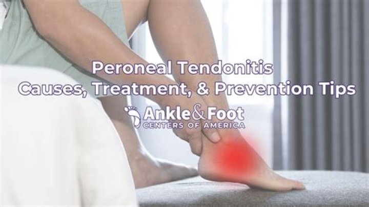 Does CBD help tendonitis?