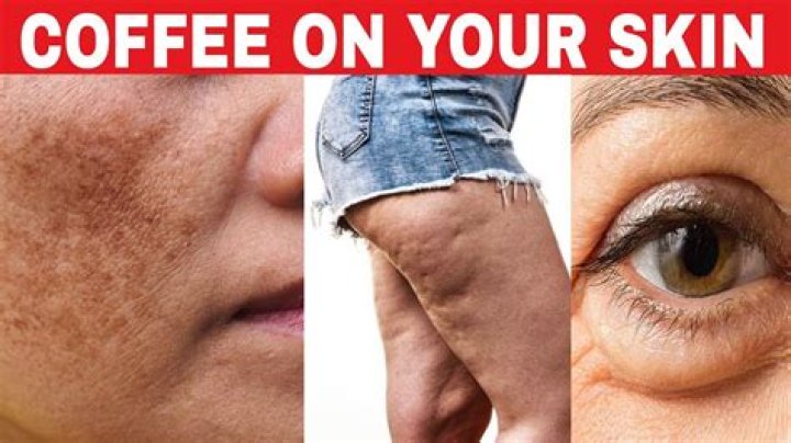 Does coffee dry your skin?