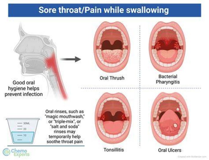 Does Covid cough start with a tickle in throat?