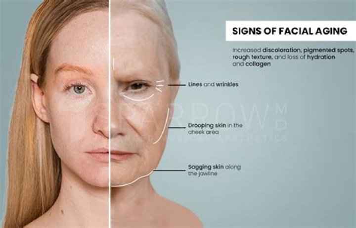 Does drinking age your skin?