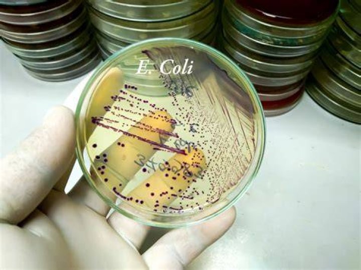 Does E. coli make you tired?