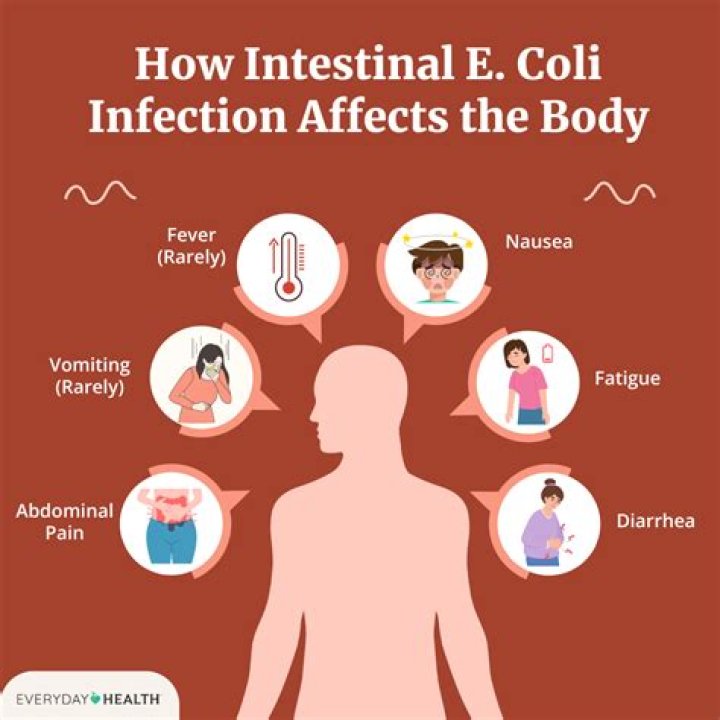 Does everyone have E. coli in their body?