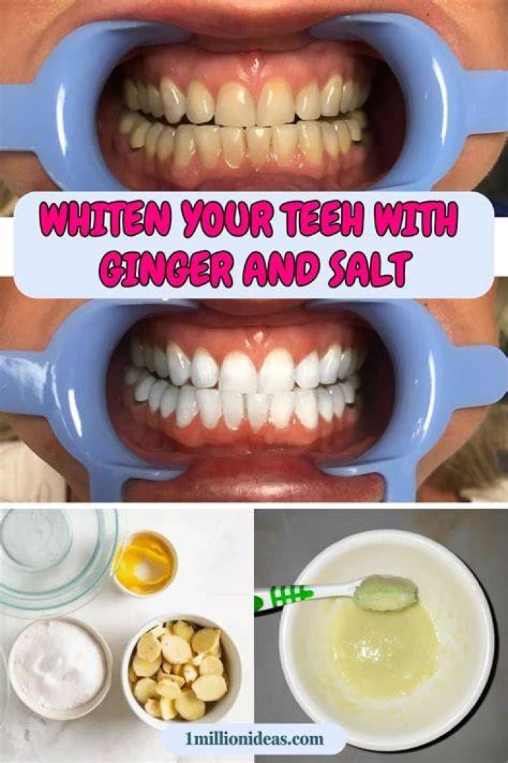 Does ginger and salt whiten teeth?