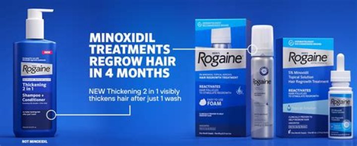 Does hair become dependent on minoxidil?