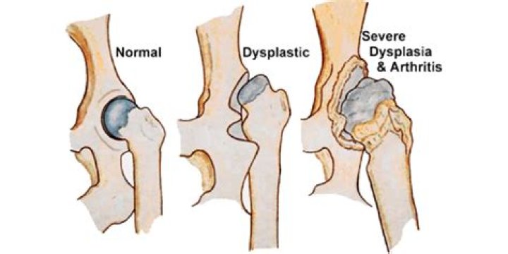 Does hip dysplasia come on suddenly?