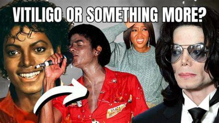 Does Michael Jackson own Elvis?