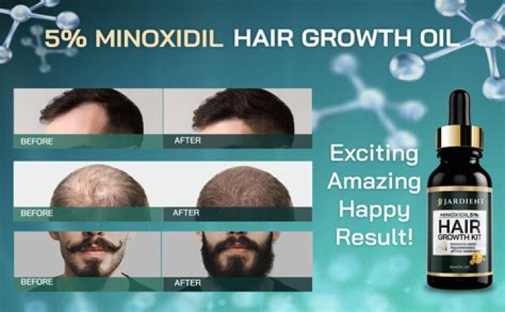 Does minoxidil grow hair faster?