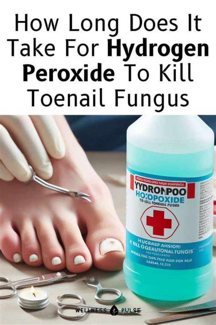 Does peroxide cure toenail fungus?