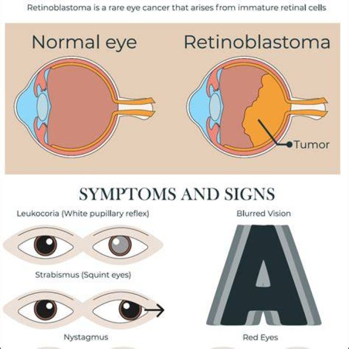 Does retinoblastoma hurt?