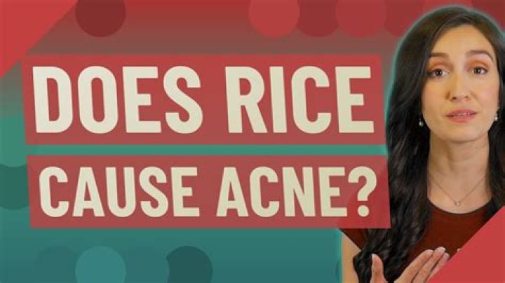 Does Rice cause acne?