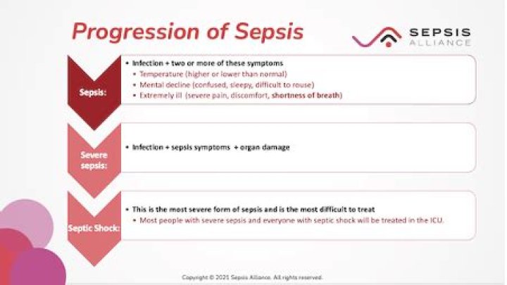 Does sepsis progress quickly?