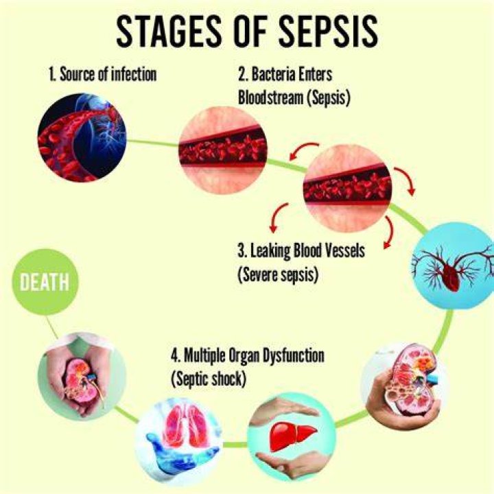 Does sepsis show up in blood work?