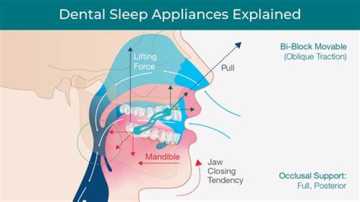 Does sleep apnea damage lungs?