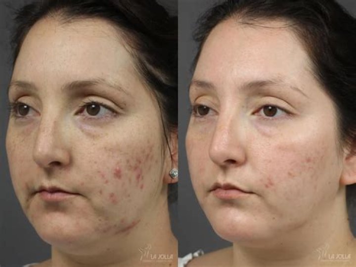 Does Sudocrem help itching?