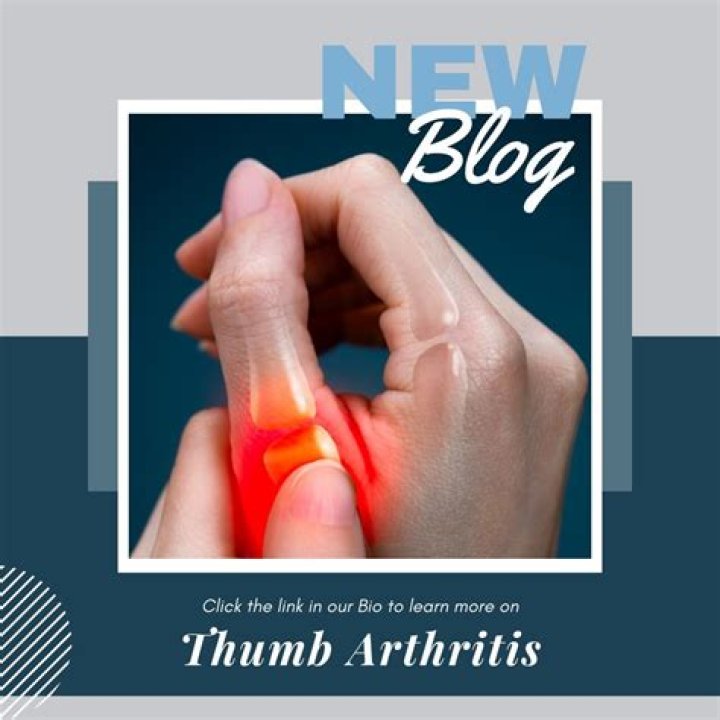 Does thumb arthritis come on suddenly?