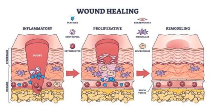 Does vitamin C interfere with wound healing?