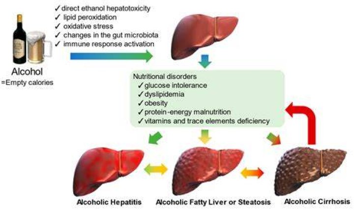 Does whiskey cause belly fat?