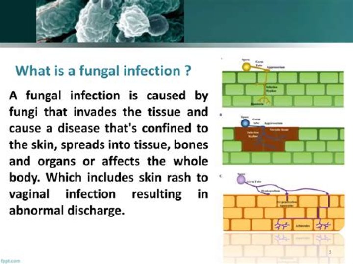 How can I boost my immune system against fungal infections?