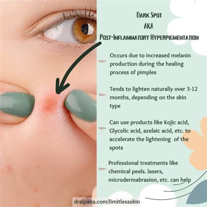 How can I get rid of dark spots in 2 days?