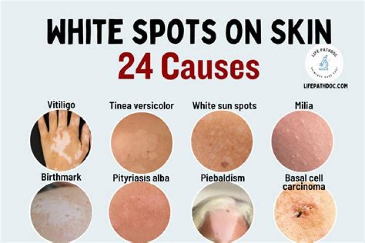 How can I get white skin in a week?
