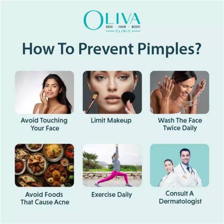 How can I prevent pimples after eating chocolate?
