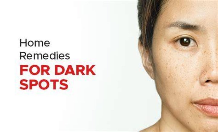 How can I remove dark spots at home permanently?