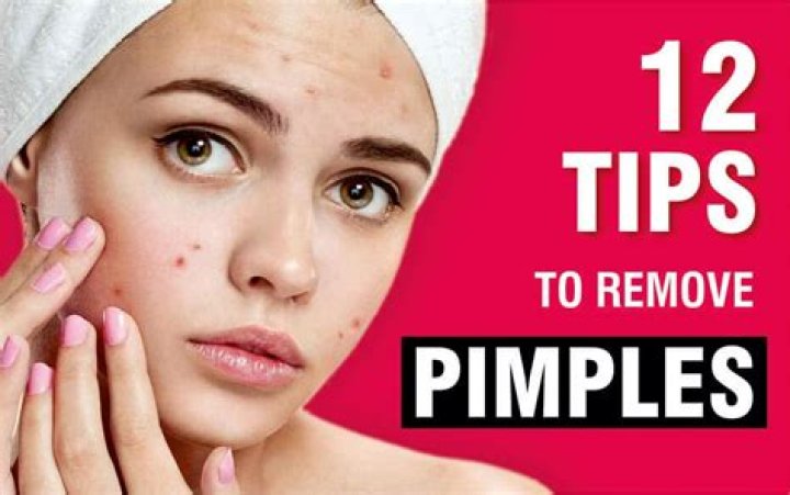How can I remove pimples from my face permanently?