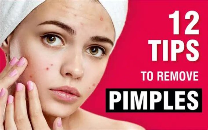 How can I remove pimples?